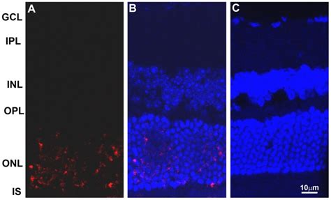 apoptosis elisa kit roche|apoptotic cell death detection.